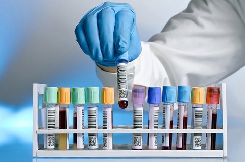 Hematokrit
