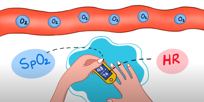 Saturacija Kiseonika u Krvi: Sve Što Treba da Znate